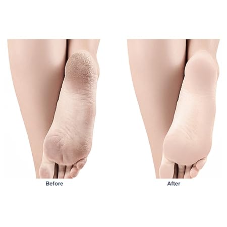 Nano Glass Foot Scraper ��� Dead Skin Exfoliating Foot Grindin